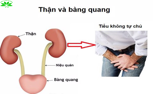 NGUYÊN NHÂN GÂY TIỂU KHÔNG TỰ CHỦ