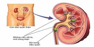 http://ichthanhoan.vn/mot-so-hieu-biet-ve-tinh-trang-di-tieu-nhieu-lan.htm
